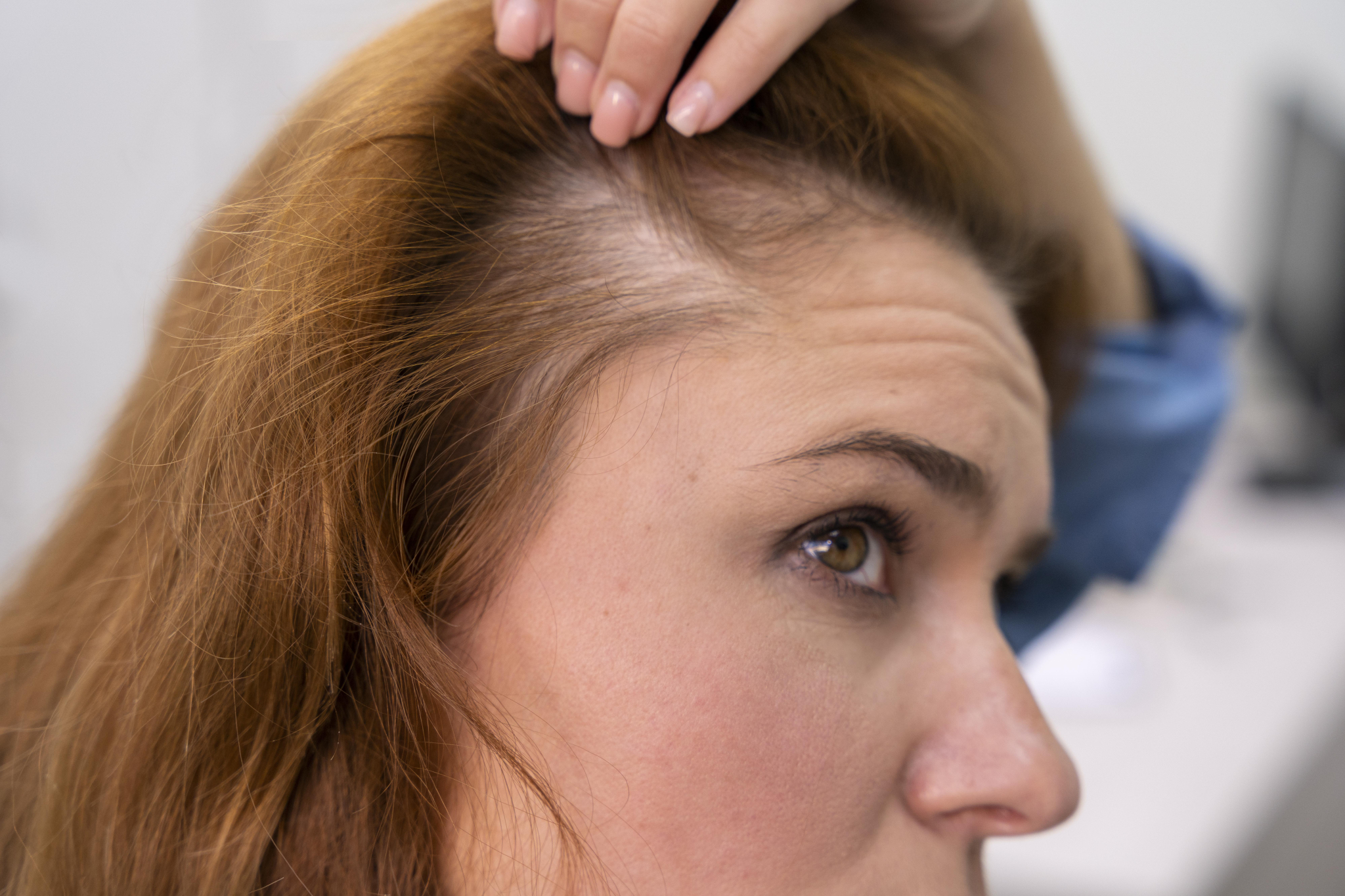 woman getting hair loss treatment clinic