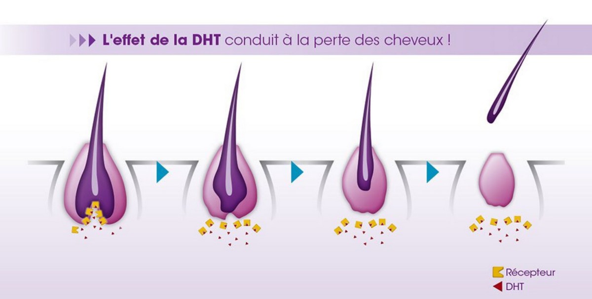 image DHT